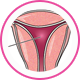 cervical cone biopsy