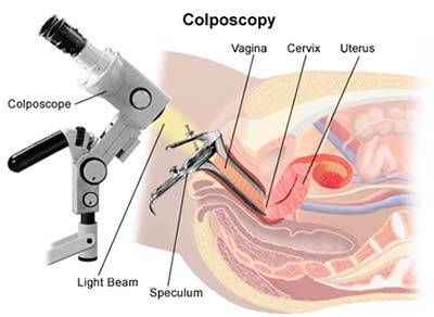 Colposcopy Specialist