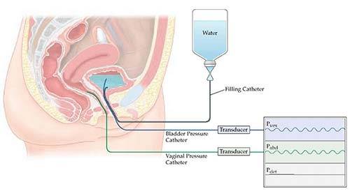 Urodynamic Testing