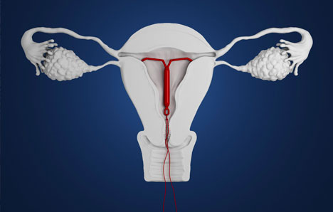 adenomyosis enlarged uterus treatment