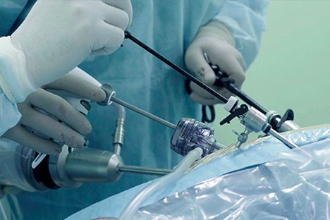 hysterectomy procedure