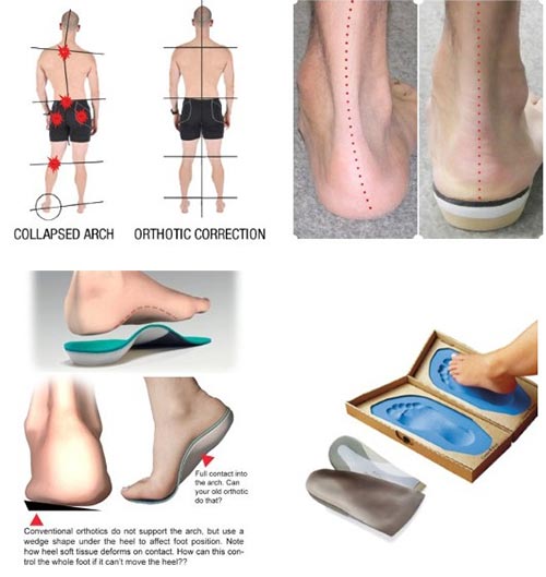 Orthotic Shoes, Supports, Insoles NYC