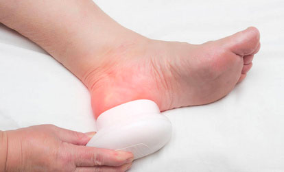 Plantar Fasciitis